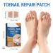 Roser 32 Piece Toenail Correction Patch | Nail Repair & Strengthening for Damaged & Discolored Nails - Buy Online on GoSupps.com