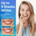 Teeth Whitening Kit Teeth Whitening Kit with LED Light - Teeth Whitening Kits Teeth Whitener Including Mouth Tray 12 Teeth Whitening Gels 3 Desensitizing Gels and Storage Case - Buy Online on GoSupps.com