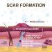 Epi-Derm Large Silicone Scar Sheet - 11 x 15.75 in - Natural - Biodermis - Buy Online on GoSupps.com
