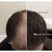 Refill kit Hair Fiber By Samson XLarge 50 Grams Hide Hair Loss and Hair Transplant Natural Looking Results Made in USA Hair Loss Concealer (Dark Brown) - Buy Online on GoSupps.com