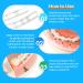 AIM DENTAL SUPPLY Lip Protector for Braces - Orthodontic Pain-Relief Mouth Guard - Custom-Fit Brace Covers - 2.0 Count - Buy Online on GoSupps.com