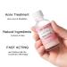 Acne Drying Lotion | Overnight Acne Treatment for Pimples & Blemishes | Fast Spot Treatment (1OZ) - International Shipping - Buy Online on GoSupps.com