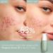 Caudalie Vinopure Natural Salicylic Acid Pore Minimizing Serum - 30mL - Buy Online on GoSupps.com