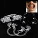 AREPAS 3pcs Dental Teeth Whitening Lip & Cheek Retractor - Autoclavable Dentist Mouth Opener for Repeated Use | International Shipping Available - Buy Online on GoSupps.com