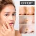 Xoermioy Purifying Balancing Massage Cream All-Natural Deep Cleansing & Exfoliating Face Cream Set (3 PCs) for Relaxation & Pore Cleansing - Buy Online on GoSupps.com