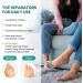 Welnove Toe Separators for Women - 4 Pack Gel Toe Straighteners for Bunions Relief & Foot Pain - Non-Slip Silicone Toe Spacers for Yoga - Blue - Buy Online on GoSupps.com