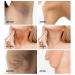 Crema Aclarante para Manchas en Cara, Axilas, Cuello y Entrepierna - Buy Online on GoSupps.com