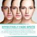 Aobenz Spot Remover for Face Anti Spot Serum Dark Spot Correcting Serum Sun Spot Dark Spot Remover Age Spot Treatment Face Serum Skin Whitening Spot and Freckle Remover Spot Treatment for Face 50ml - Buy Online on GoSupps.com