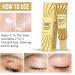 Yuemei Scar Vanishing Cream - Strengthen Skin Repair, Remove Old Scars & Stretch Marks | Suitable for All Skin Types - Buy Online on GoSupps.com