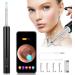 Enjoyee Wireless Ear Wax Removal Kit with 1080P HD Ear Camera for iPhone, iPad & Android - Black - Buy Online on GoSupps.com