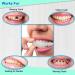 Temporary Trim Snap On Veneers - Natural Shade for Men and Women | 2pcs Dental Repair Teeth - Buy Online on GoSupps.com