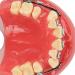 Orthodontic Demonstration Model | Professional Dental Model with Metal Wires & Brackets for Learning | International Shipping Available - Buy Online on GoSupps.com