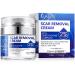 Scar Removal Cream - Advanced Scar Treatment Gel for Surgical Scars Acne Scars C-Section Burns Stretch Marks - for Old and New Scars
