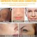 Turmeric Dark Spot Corrector Serum 2022 New Dark Spot Remover for Face Facial Serum Bright Skin & Hydrating Face Care Spot Cream (60 ML) - Buy Online on GoSupps.com