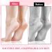 2Pairs Silicone Socks for Dry Cracked Feet Women Moisturizing Foot Socks Soft Gel Socks Aloe Socks Women's Spa Pedicure Foot Care Socks for Repairing Dry Feet Cracked Heel and Softening Rough Skin - Buy Online on GoSupps.com