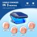 Nail Fungus Cleaning Device for Multiple fingers 905nm Infrared Light + 470nm Blue Light Highly Effective Treatment for Home Use Treat and effectively prevent (Navy) - Buy Online on GoSupps.com