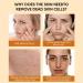 Orange Peeling Gel - 50g Effective Cleanser for Deep Exfoliators | Light Organic Face & Body Scrub Gel | Moisturizing Facial Scrub - Buy Online on GoSupps.com