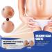 Silicone Gel Scar Patch for Stretch Marks, Burns & Cuts - Smooth Skin Fix for Baby & Child Personal Care (One Size) - Buy Online on GoSupps.com