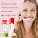 Sp6 Probiotic Toothpaste - Ultra Whitening Oral Health & Fresh Breath | International Shipping - Buy Online on GoSupps.com