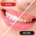 Prasacco 25 Pcs Interdental Brushes - L-Shaped 1.2mm Plastic Non-Slip Handle for Effective Tooth Cleaning & Oral Care (Red) - International Shipping Available - Buy Online on GoSupps.com