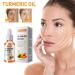Turmeric Dark Spot Corrector Serum - Acne, Hyperpigmentation, Smooth Skin - Hyaluronic Acid, Vitamin C & E - 1.01 FL.OZ - Buy Online on GoSupps.com
