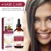 Natural Hair Growth Oil - Formula with Nourishing Jojoba Oil Strengthening for Fine and Weak Hair | Moisturizing Anti-Frizz Treatment 30ml to Boost Density and - Buy Online on GoSupps.com
