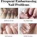 Nail Cuticle Oil 15ml with Organic Vitamin E & B Avocado Essence Cuticle Oil with Dropper Design for Nails Moisturizes Cuticle and Nail's Skin Strengthens Nails Prevents Hangnails and Chapped 20ML - Buy Online on GoSupps.com