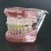 Buy Luceae Dental Orthodontic Demonstration Model | Self-Ligating Retainer Treatment for Dentures - International Shipping Available - Buy Online on GoSupps.com