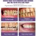 3 Days Teeth Whitening Pearl Probiotic Tooth Powder Has Refreshing Taste Refreshing Mint Flavor Effective Teeth Whitening Remove Stains (1pc) - Buy Online on GoSupps.com