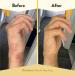 ECZEMA HONEY Antioxidant Body Oil - Unscented Moisturizing Spray for Eczema-Prone Skin - Perfect for Women Men & Kids - 8 Fl Oz - Buy Online on GoSupps.com