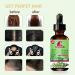 Rosemary Oil for Scalp & Hair Strengthening Nourishes Scalp Thickening Moisture and Hair Loss Regrowth Hair Growth Oil rosemary hair oil for Men and Women 60ML - Buy Online on GoSupps.com