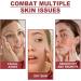 Coffret Collag nes Fondants Film de Levage High Prime Skincare Avec des Collag nes Hydrolys s Pr venir les Ridules Peau Ferme Protection de la Peau pour les Femmes Convient Toute la Peau (1Bo te) - Buy Online on GoSupps.com