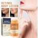 Skin Firming Cream - Firming and Tightening Lotion Body Care Cream | Effective Body Lotion with Deep Nourishing Formula for Abdomen - Buy Online on GoSupps.com