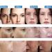 Dark Spot Remover Serum for Face with Vitamin C, Retinol, Salicylic Acid & More - Hyperpigmentation & Acne Scar Treatment - Buy Online on GoSupps.com