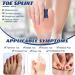 Jutom 4-Piece Toe Splint Set for Hammer Toe Correction - Blue - Buy Online on GoSupps.com