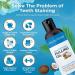 Coconut Oil Pulling for Teeth (230 mL) | Natural Ayurvedic Mouthwash for Fresh Breath Healthy Gums & Teeth Whitening | Alcohol-Free - Buy Online on GoSupps.com