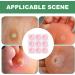 Corn Removers for Toes Round Foam Pads | Soft Foam Callus Cushions Corn Patches Foot Toes Adhesive Foot Care Cushions Provide Gentle Support for Feet Women Men - Buy Online on GoSupps.com