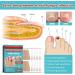 (Most Gifted) 2024 New 3Box/48pcs Anti F-ungal Nail T-reatment P-atches Toe F-ungus O-nychomycosis Repair S-Ticker - Buy Online on GoSupps.com