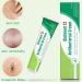Cr me Anti-D mangeaisons Pommade Anti-Morsures - Soin Naturel Action Rapide pour Femmes Hommes Nuit et Voyage - Buy Online on GoSupps.com