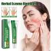 Herbal Eczema Ointment - 3 Pieces for Itch Relief Redness Reduction & Moisturizing | Fast Absorbing Herbal Extracts - Buy Online on GoSupps.com