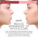 PURA DOR Organic Scar & Stretch Mark Treatment Oil | 1oz For Skin - Rosehip, Wheat Germ, Argan, Tamanu, Carrot, Rosemary, Lavender, Geranium, Patchouli, Sage - Buy Online on GoSupps.com