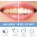 Shop 2x Tooth Whitening Pen - Gentle & Effective Teeth Whitening Kit by Abbey Professional - Buy Online on GoSupps.com