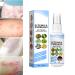 DUBUSH Meellop Herbal Psoriasis Relief Spray Skin Eczema Relief Spray Eczema Relief Soothing and Moisturizing Psoriasis Treatment Spray (3PCS) 1pcs