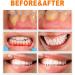 2 Box Gum Repair Treatment Ampoules | Teeth Whitening Serum & Instant Gel for Tartar Removal & Gum Protection - Buy Online on GoSupps.com