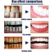 Tooth Elevator: Whitening Toothpaste for Fresh Breath & Bright White Teeth - Ideal for Smokers - Buy Online on GoSupps.com