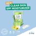 St. Ives Clear Skin Lotion SPF 25 - 3-in-1 Acne Prone Face Moisturizer - Tea Tree & Witch Hazel - 3 Fl Oz - Buy Online on GoSupps.com