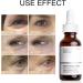 2PCS Caffeine Solution 5%+EGCG Eye Serum Caffeine Eye Serum Caffeine Eye Cream Anti Aging Under Eye Cream for Dark Circles and Puffy Eyes Instant Wrinkle Remover Eye Bag Removal Fade Fine Line 30ML - Buy Online on GoSupps.com