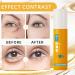 Luteine Yeux Lut ine Eye Oil VC Lut ine huile essentielle contour des yeux VC s rum anti-rides la lut ine s rum contour des yeux anti- ge pour l' limination des rides (8ML 1PC) 1PC 8 ml (Lot de 1) - Buy Online on GoSupps.com