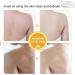 Lovelycat Savon de papaye claircissant la peau le savon de papaye contenant de l'acide hyaluronique r tinol am liore le teint in gal et hydrate le corps et le visage (2PC) - Buy Online on GoSupps.com
