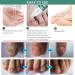 Extra Strong Fungal Nail Treatment for Toenails - Nail Repair Oil for Ingrown Nails - Strengthen and Renew Damaged Nails - 3Pcs Set - Buy Online on GoSupps.com